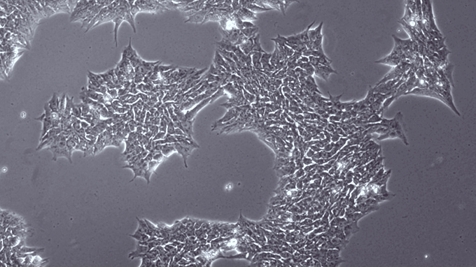 新しい培養条件でのヒト多能性幹細胞